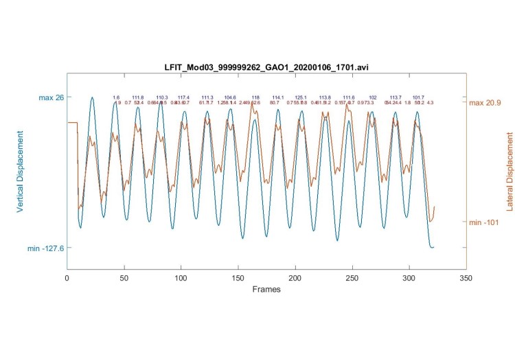 Movement Graphing